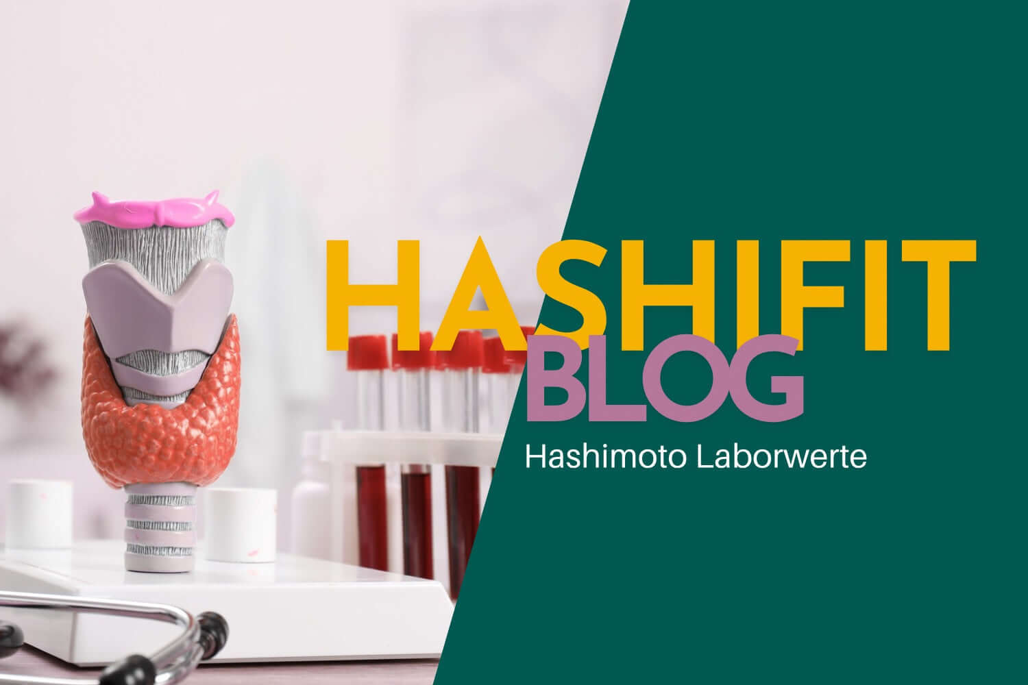 Hashifit Blog zu Hashimoto Laborwerten – Modell einer Schilddrüse mit Blutproben im Labor, Symbolbild für ganzheitliche Schilddrüsendiagnostik und Körperkommunikation.