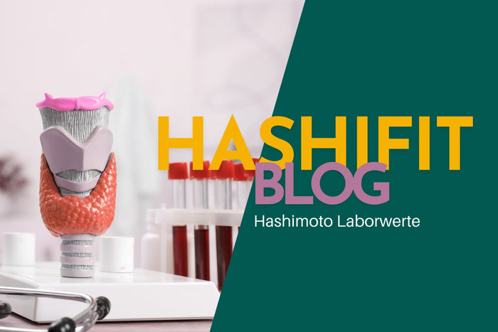 Hashifit Blog zu Hashimoto Laborwerten – Modell einer Schilddrüse mit Blutproben im Labor, Symbolbild für ganzheitliche Schilddrüsendiagnostik und Körperkommunikation.